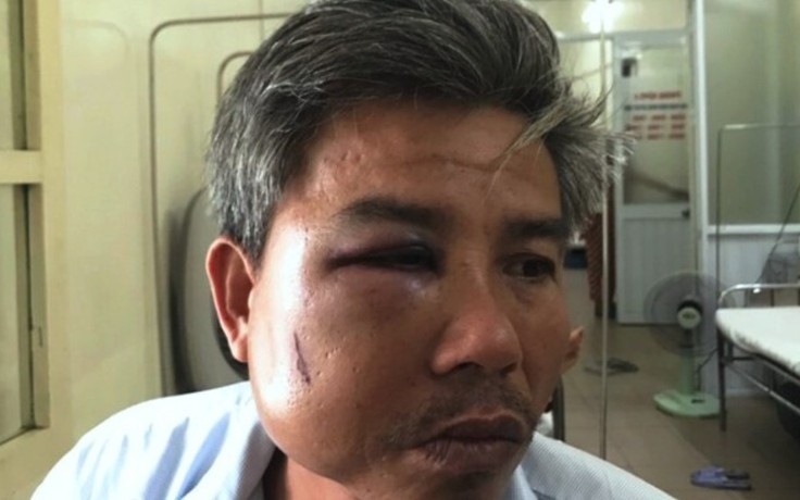 Thừa Thiên - Huế: Chủ quán cà phê Bố Già hành hung nhân viên cây xanh, bị khởi tố