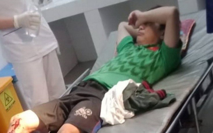 Thừa Thiên - Huế: Thầy giáo bị trộm 2 lần vào vườn hái cau, tấn công nhập viện