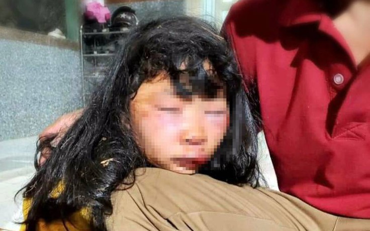 Nữ sinh lớp 6 bị đánh dã man, bất tỉnh trong lô cao su