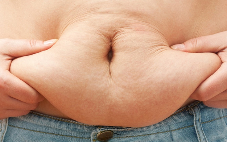 Nguy cơ nhiễm Covid-19 ở người béo phì