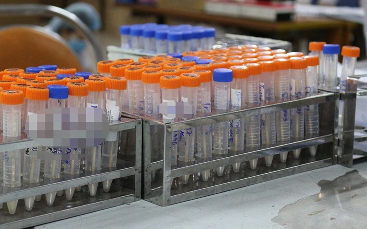‘Loạn’ giá test nhanh, xét nghiệm PCR Covid-19