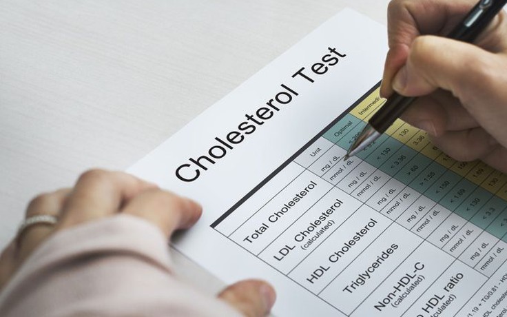 Chuyên gia: Các triệu chứng cholesterol cao cần theo dõi