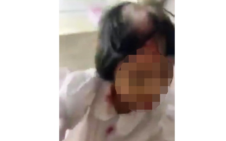 Bé gái 9 tuổi ở Thanh Hóa bị mẹ ruột đánh đập gây thương tích