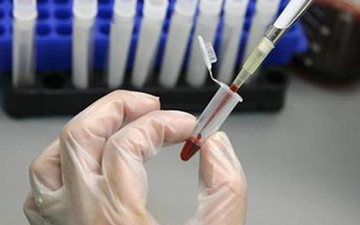 Bác sĩ dùng ống tiêm bẩn truyền HIV hơn 100 người