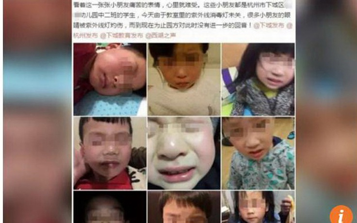 8 trẻ mẫu giáo ở Trung Quốc bị bỏng mắt do giáo viên bất cẩn