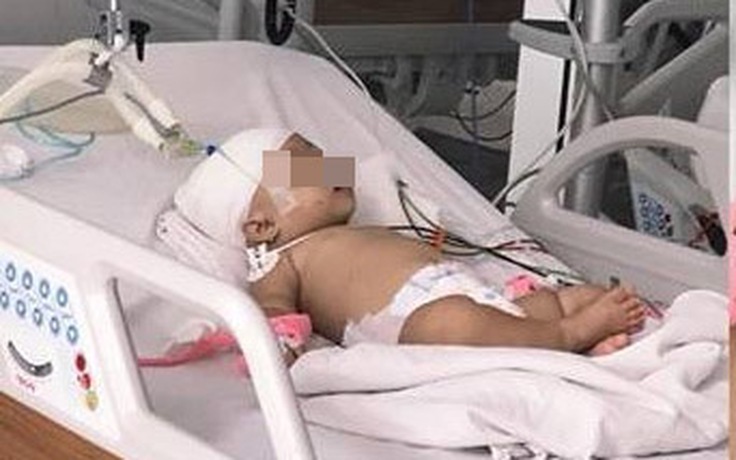 Khỉ sổng chuồng tấn công bé 14 tháng tuổi trọng thương