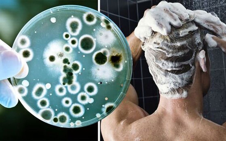 Một nơi trong phòng tắm có thể là ổ chứa vi khuẩn chết người