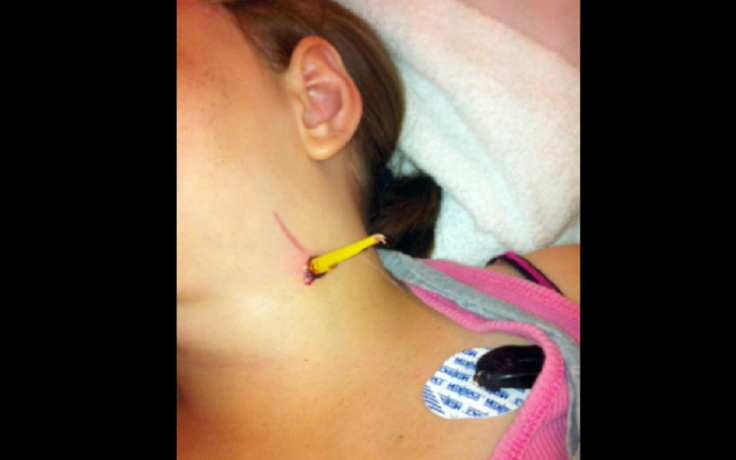 Nữ sinh bị bút chì đâm vào cổ làm tắc nghẽn động mạnh