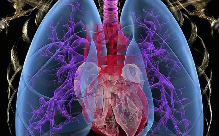 5 dấu hiệu khó ngờ 'tố cáo' bạn có thể mắc bệnh phổi