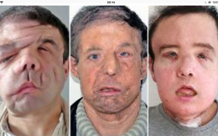 Người đàn ông ở Pháp có đến 3 khuôn mặt