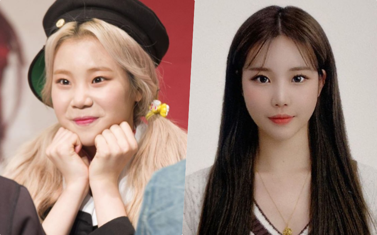 Idol 'xấu xí nhất làng giải trí Hàn' gây sốc với dung mạo 'lột xác' xinh đẹp