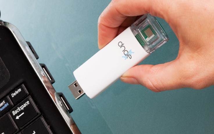 Phát triển thành công USB có thể xét nghiệm virus HIV