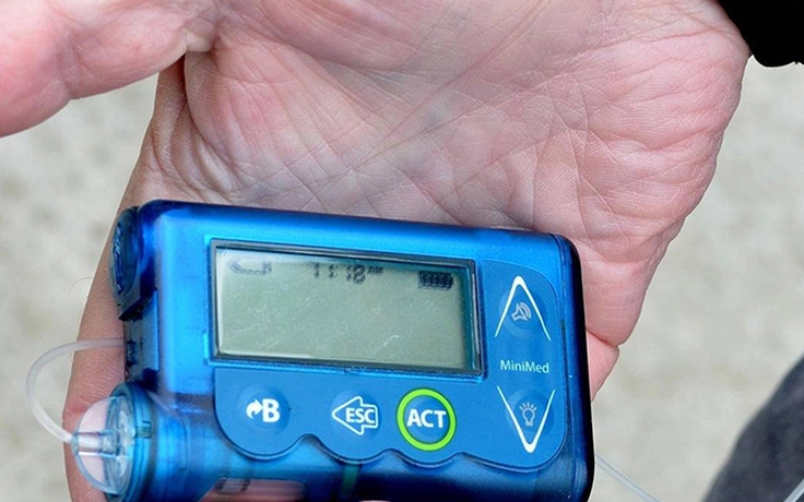 Hàng ngàn máy bơm insulin không dây có thể bị hack