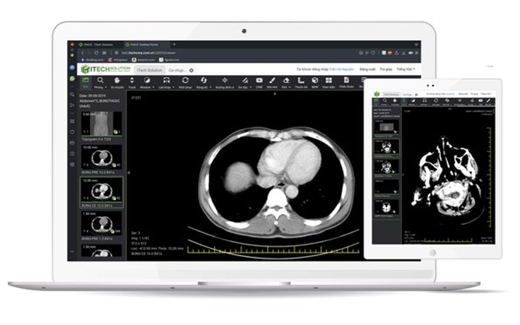 Ra mắt ứng dụng hỗ trợ chẩn đoán hình ảnh từ xa IPACS Telerad
