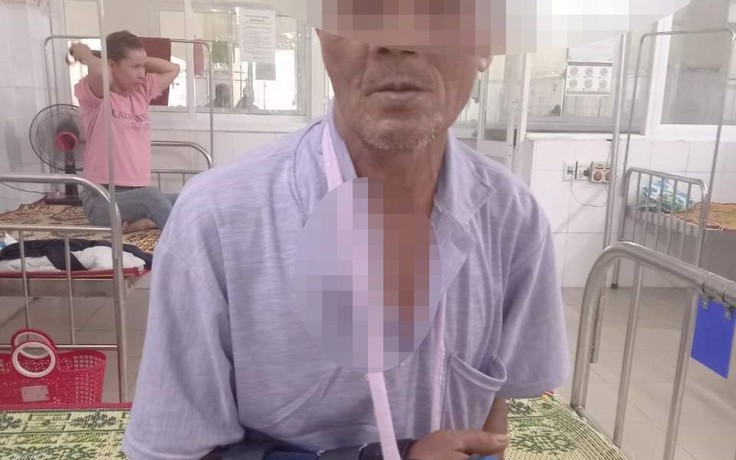Quảng Trị: Người đàn ông 65 tuổi nhập viện vì bị khỉ tấn công