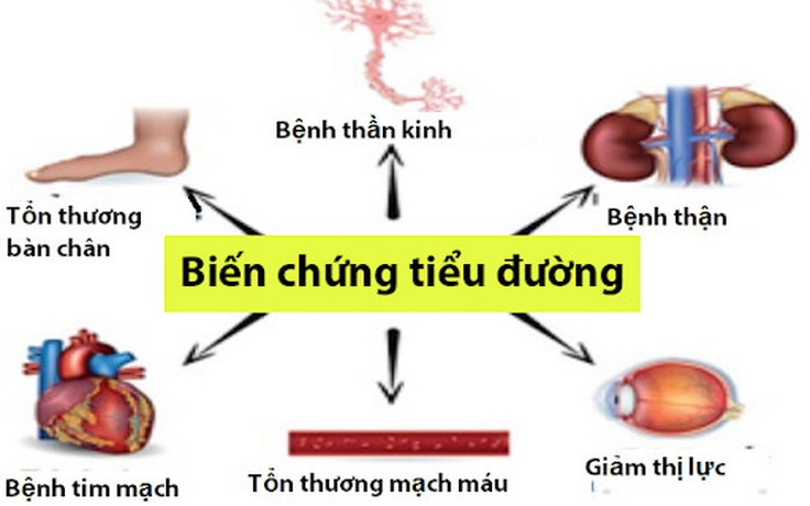 Phương pháp hỗ trợ giảm nguy cơ biến chứng do đái tháo đường