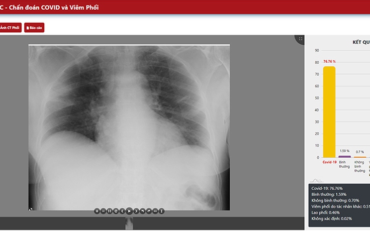 ĐH Duy Tân phát triển ứng dụng Phát hiện Covid-19 qua xử lý phim Xquang, CT