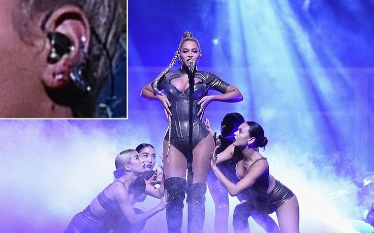 Beyoncé diễn sung bất chấp tai nạn rách tai chảy máu