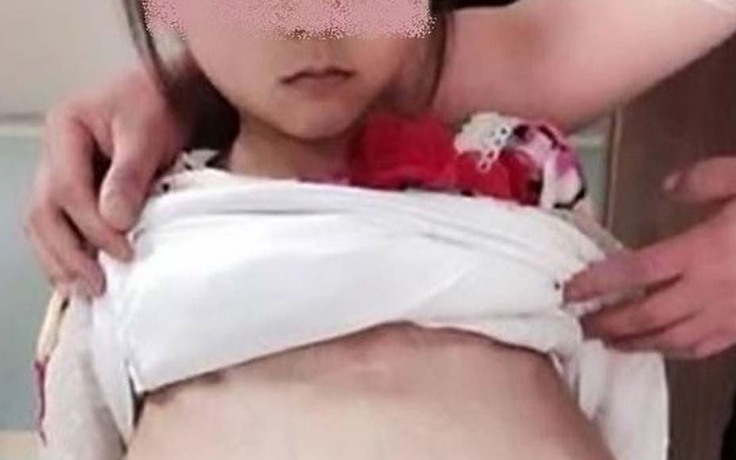 Bộ Công an đang làm rõ vụ bé gái Việt 12 tuổi mang thai tại Trung Quốc