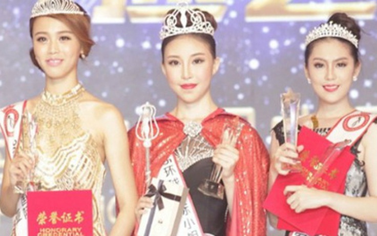 Hoa hậu Hoàn cầu Trung Quốc không dám cười vì răng hô