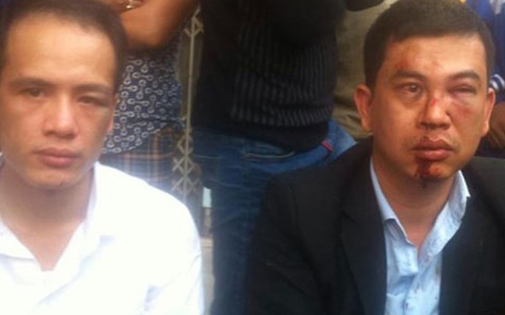 Hai luật sư bảo vệ Đỗ Đăng Dư bị côn đồ hành hung: ‘Nhiều vấn đề chưa được làm rõ'