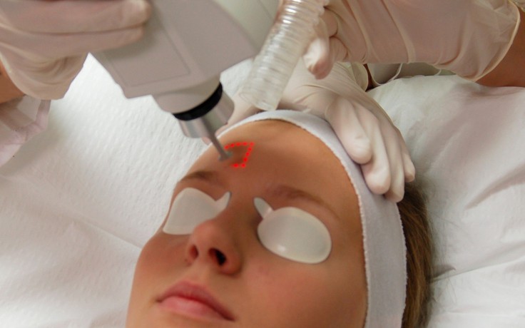 Câu chuyện của laser trong công cuộc làm đẹp