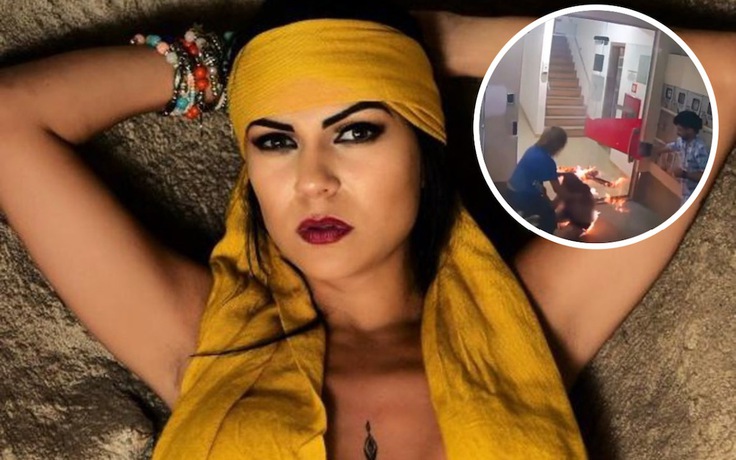 Nữ người mẫu Brazil bốc cháy sau khi tranh cãi với bạn gái