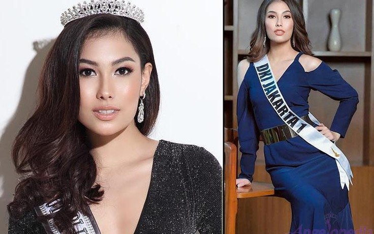 Hoa hậu Indonesia khốn khổ vì thẩm mỹ hỏng