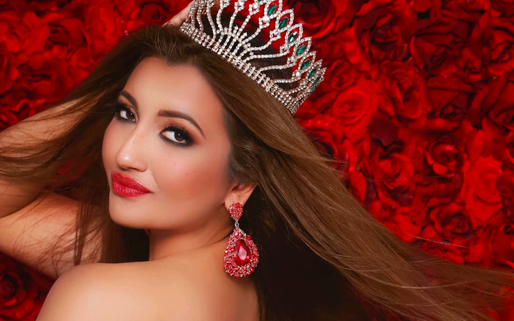 Shree Saini: Cô gái biến dạng mặt vì bỏng trở thành á hậu Miss World