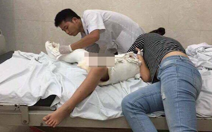 Học sinh gãy chân tại Trường tiểu học Nam Trung Yên bị thương tật 32%