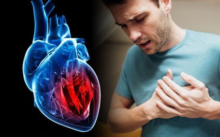 Gặp 3 triệu chứng này khả năng là cơn đau tim rất cao