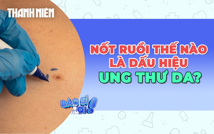 Cảnh báo những nốt ruồi bất thường là dấu hiệu của ung thư da