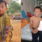 Cái kết ấm lòng cho cậu bé gãy tay phải bó bằng củi khô