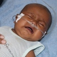 'Con muốn sống': Xin cứu mắt còn lại của bé gái Ba Na 7 tháng tuổi
