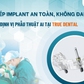 Cấy ghép Implant an toàn, không đau với máng định vị phẫu thuật AI tại True Dental