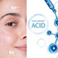 Hyaluronic Acid là gì? Có đang phí tiền khi sử dụng sản phẩm skincare chứa HA?