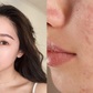 Top 10 kem chống nắng cho da mụn thông thoáng, không bóng nhờn, ngừa mụn hiệu quả