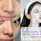 Rửa mặt cứ tưởng là sạch ai ngờ ‘kích hoạt’ lỗ chân lông to đùng!