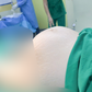 Phẫu thuật cắt tử cung vì khối u xơ khổng lồ nặng hơn 4 kg