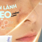 Sẹo rỗ không phải ‘một loại’: Vì sao nhiều người điều trị mãi vẫn không đẹp?