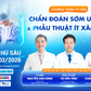 Chuyên gia tư vấn về phương pháp mới trong chẩn đoán và điều trị u phổi