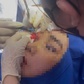 35.000 ca tai biến thẩm mỹ mỗi năm: Cảnh báo tử vong, mù mắt