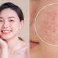 Hết tình trạng bí da mùa hè: Sản phẩm phục hồi này đang gây sốt khắp TikTok