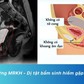 14 tuổi chưa ‘rụng dâu’, thăm khám bất ngờ phát hiện bé gái không có tử cung