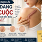 Lý do thật sự khiến nhiều người điều trị sẹo không thành công