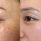 +5 serum mờ nám hỗn hợp, kể cả nám lâu năm cũng cải thiện nhanh chóng