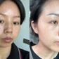 Top 6 serum giúp nám đậm màu cũng bật tone trắng hồng, kể cả nám chân sâu