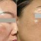 +5 serum mờ nám mảng loang lổ khắp mặt cũng cải thiện, da bật tone trắng hồng