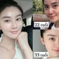 Chuyên gia gợi ý cách bảo tồn collagen ngăn ngừa lão hóa mà không tốn đồng nào