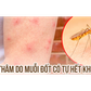 Bị sẹo thâm do muỗi đốt và côn trùng cắn có trị hết được không?